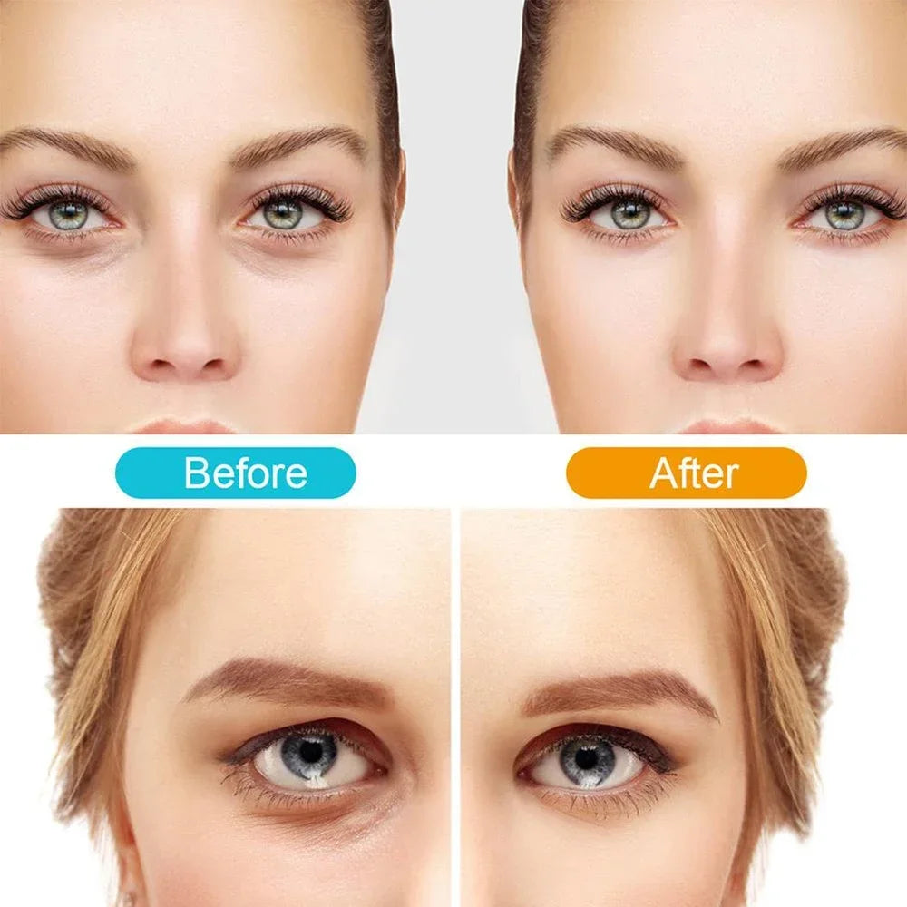 Masajeador de ojos VisionRelax